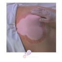 PA: PREVENZIONE DELLE LESIONI DA DECUBITO