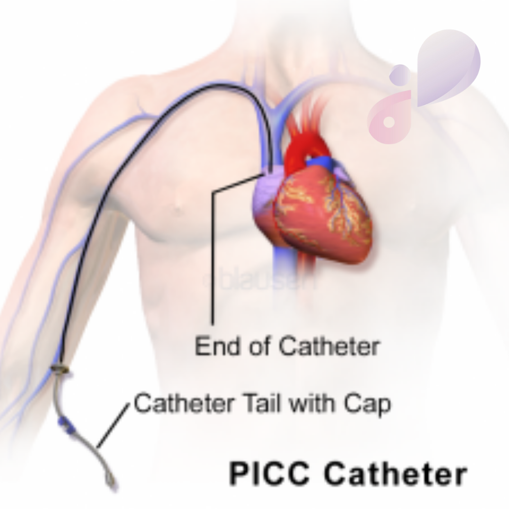 PA: SORVEGLIANZA E GESTIONE DI PICC